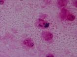 顕微鏡写真：喀痰（ブドウ球菌）