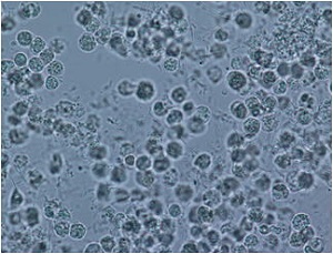 顕微鏡写真：白血球