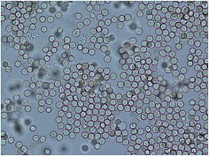 顕微鏡写真：赤血球