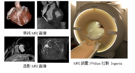写真：単純MRI画像、造影MRI画像、MRI装置 Philips社製 Ingenia