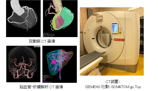 写真：冠動脈CT画像、脳血管肝臓解析CT画像、CT装置 SIEMENS社製 SOMATOM go.Top